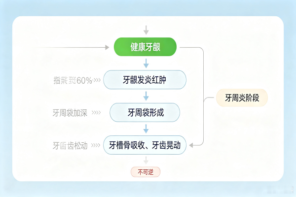 牙周治疗牙周炎发展阶段示意图